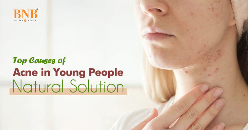 Top Causes of Acne in Young People