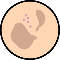 Pigmentation