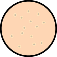 Open Pores